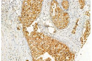 ABIN6262304 and ABIN6272944 at 1/100 staining Human normal tissues adjacent to lung cancer by IHC-P. (HMGCS1 Antikörper  (Internal Region))