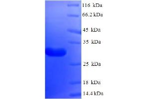 SDS-PAGE (SDS) image for Nanos Homolog 2 (NANOS2) (AA 1-138), (full length) protein (His-SUMO Tag) (ABIN5709987)