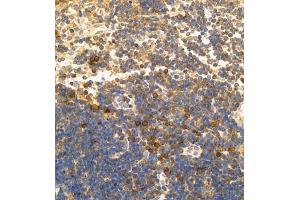 Immunohistochemistry (Paraffin-embedded Sections) (IHC (p)) image for anti-Tumor Necrosis Factor Receptor Superfamily, Member 8 (TNFRSF8) antibody (ABIN7076073)