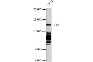 Western blot analysis of extracts of MCF7 cells, using FAK pAb (ABIN6131637, ABIN6135867, ABIN6135868 and ABIN7101374) at 1:1000 dilution. (FAK Antikörper)