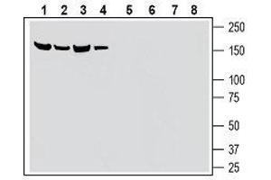 Western blot analysis of mouse kidney membranes (lanes 1 and 5), rat pancreas lysates (lanes 2 and 6), mouse brain membranes (lanes 3 and 7) and rat brain lysate (lanes 4 and 8): - 1-4. (SLC28A3 Antikörper  (5th Extracellular Loop))