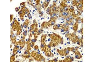 Immunohistochemistry of paraffin-embedded Human liver damage using SMAD9 Polyclonal Antibody at dilution of 1:100 (40x lens).