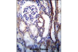 ATP6V1B1 Antibody immunohistochemistry analysis in formalin fixed and paraffin embedded human kidney tissue followed by peroxidase conjugation of the secondary antibody and DAB staining. (ATP6V1B1 Antikörper  (AA 284-310))