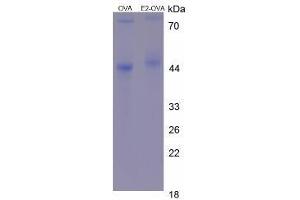 Image no. 2 for E2 Estradiol protein (Ovalbumin) (ABIN1880302) (E2 Estradiol Protein (Ovalbumin))