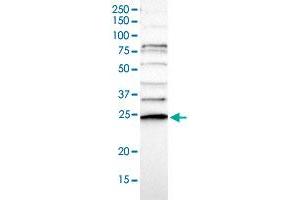 Western blot analysis of Human cell line RT-4 with CD34 polyclonal antibody  at 1:100-1:250 dilution. (CDC34 Antikörper)