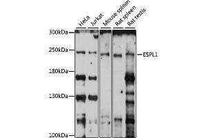 Western blot analysis of extracts of various cell lines, using ESPL1 antibody (ABIN7267070) at 1:1000 dilution. (Separase Antikörper  (AA 1220-1500))