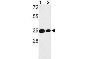 Western blot analysis of TAZ antibody and (1) MDA-MB231 and (2) NCI-H460 lysate. (TAZ Antikörper  (AA 32-60))