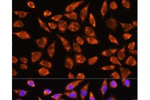 Immunofluorescence analysis of L929 cells using MARK2 Polyclonal Antibody at dilution of 1:100. (MARK2 Antikörper)