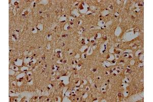 IHC image of ABIN7139735 diluted at 1:100 and staining in paraffin-embedded human brain tissue performed on a Leica BondTM system. (AXIN2 Antikörper  (AA 56-73))