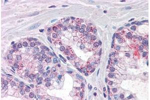 Human Prostate (formalin-fixed, paraffin-embedded) stained with PDE11A antibody ABIN337393 at 10 ug/ml followed by biotinylated anti-goat IgG secondary antibody ABIN481715, alkaline phosphatase-streptavidin and chromogen. (PDE11A Antikörper  (AA 455-468))