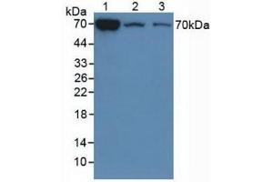 Detection of CHI3L1 in Mouse Liver Tissue, 2: Mouse Lung Tissue,3:Mouse Spleen Tissue using Polyclonal Antibody to Chitinase-3-like Protein 1 (CHI3L1) (CHI3L1 Antikörper  (AA 112-356))