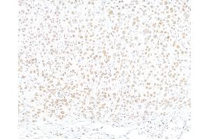 Immunohistochemistry (IHC) image for anti-Tripartite Motif Containing 28 (TRIM28) (AA 650-700) antibody (ABIN7453436)