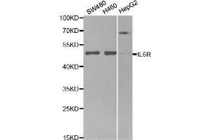 Western blot analysis of extracts of various cell lines, using IL6R antibody. (IL-6 Receptor Antikörper  (AA 20-320))