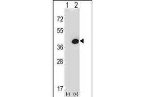 Western blot analysis of FBP1 (arrow) using rabbit polyclonal FBP1 Antibody (Center) (ABIN391577 and ABIN2841512). (FBP1 Antikörper  (AA 125-156))