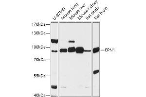 Western blot analysis of extracts of various cell lines, using EPN1 antibody (ABIN7267000) at 1:1000 dilution. (Epsin 1 Antikörper  (AA 130-180))