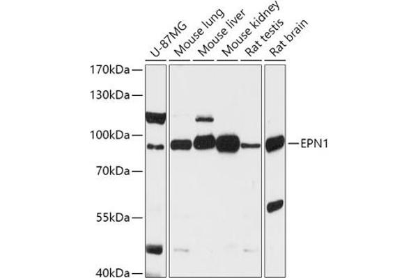 Epsin 1 Antikörper  (AA 130-180)