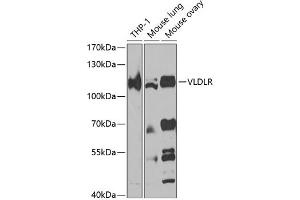 Western blot analysis of extracts of various cell lines, using VLDLR antibody (ABIN7271310) at 1:1000 dilution. (VLDLR Antikörper  (AA 20-210))
