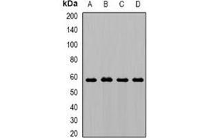 Western blot analysis of AMY1 expression in SKOV3 (A), mouse liver (B), mouse pancreas (C), rat heart (D) whole cell lysates.