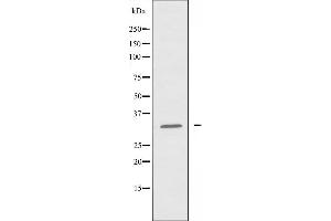 Western blot analysis of extracts from HeLa cells using Cytochrome c-type Heme Lyase antibody. (HCCS Antikörper  (Internal Region))