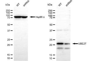 Western blotting analysis using UBE2T antibody (ABIN7800752). (Ube2t Antikörper)