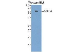 Western Blotting (WB) image for anti-Carboxypeptidase N Subunit 1 (CPN1) (AA 221-449) antibody (ABIN1858481)