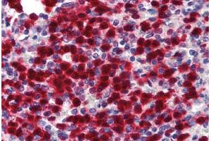 Human Spleen (formalin-fixed, paraffin-embedded) stained with CDA antibody ABIN293380 at 5 ug/ml followed by biotinylated goat anti-rabbit IgG secondary antibody ABIN481713, alkaline phosphatase-streptavidin and chromogen. (CDA Antikörper  (N-Term))