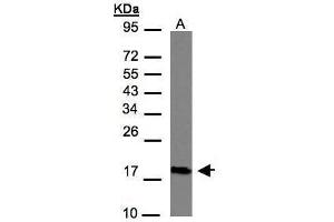 WB Image Sample(30 μg of whole cell lysate) A:Hep G2, 12% SDS PAGE antibody diluted at 1:1000 (CMTM6 Antikörper  (C-Term))