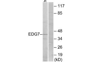 Western blot analysis of extracts from Jurkat cells, using EDG7 antibody. (LPAR3 Antikörper  (Internal Region))