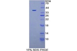 SDS-PAGE analysis of Human Plasminogen Protein. (PLG Protein)