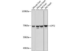 Western blot analysis of extracts of various cell lines, using CPT2 Rabbit mAb (ABIN7266090) at 1:1000 dilution. (CPT2 Antikörper)