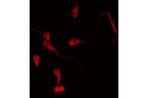 ABIN6269085 staining MDA-MB-231 by IF/ICC. (ErbB2/Her2 Antikörper  (C-Term))