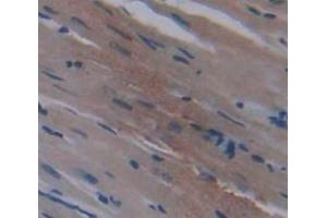 IHC-P analysis of Kidney tissue, with DAB staining. (METRN Antikörper  (AA 22-291))