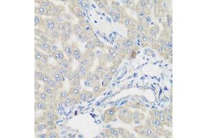 Immunohistochemistry of paraffin-embedded rat liver using PYCR1 antibody at dilution of 1:200 (40x lens). (PYCR1 Antikörper)