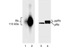 Western Blotting (WB) image for anti-Retinoblastoma 1 (RB1) (AA 514-610), (underphosphorylated) antibody (ABIN967418) (Retinoblastoma 1 Antikörper  (underphosphorylated))