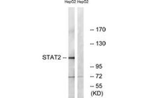 Western blot analysis of extracts from HepG2, using STAT2 (Ab-690) Antibody. (STAT2 Antikörper  (AA 656-705))