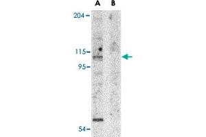 Western blot analysis of APAF1 in K-562 cell lysate with APAF1 polyclonal antibody  at 1 ug/mL in the (A) absence and (B) presence of blocking peptide. (APAF1 Antikörper  (N-Term))