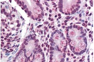 Small intestine, Human: Formalin-Fixed, Paraffin-Embedded (FFPE) (TMPRSS4 Antikörper  (Internal Region))
