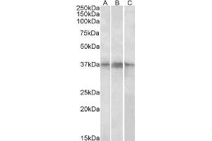 ABIN1686788 (1µg/ml) staining of Daudi,(A) Jurkat (B) and Jurkat nuclear (C) lysates (35µg protein in RIPA buffer).