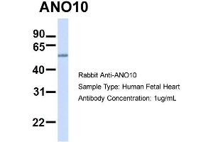 Host:  Rabbit  Target Name:  ANO10  Sample Type:  Human Fetal Heart  Antibody Dilution:  1.