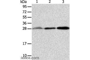 Western blot analysis of Human fetal liver and seminoma tissue, RAW264. (ALKBH2 Antikörper)