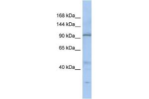 WB Suggested Anti-C20orf194 Antibody Titration:  0. (C20orf194 Antikörper  (N-Term))