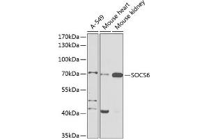 Western blot analysis of extracts of various cell lines, using SOCS6 antibody (ABIN6128785, ABIN6148273, ABIN6148274 and ABIN6225294) at 1:1000 dilution. (SOCS6 Antikörper  (AA 1-210))