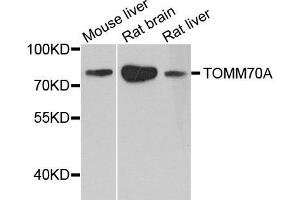 Western Blotting (WB) image for anti-Translocase of Outer Mitochondrial Membrane 70 (TOMM70A) (AA 60-340) antibody (ABIN6220597) (TOM70 Antikörper  (AA 60-340))