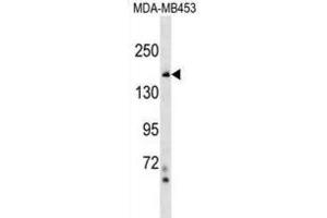 Western Blotting (WB) image for anti-Tonsoku-Like, DNA Repair Protein (NFKBIL2) antibody (ABIN2999689)