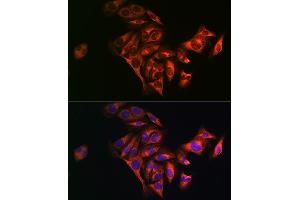 Immunofluorescence analysis of U2OS cells using Fatty Acid Synthase (FASN) Rabbit pAb (ABIN3020990, ABIN3020991, ABIN3020992 and ABIN6213855) at dilution of 1:100 (40x lens). (Fatty Acid Synthase Antikörper  (AA 2212-2511))