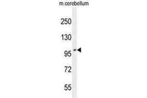 Western Blotting (WB) image for anti-ADAM Metallopeptidase with Thrombospondin Type 1 Motif, 10 (ADAMTS10) (AA 217-248), (N-Term) antibody (ABIN950271)