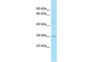 WB Suggested Anti-GPR84 Antibody Titration: 1. (GPR84 Antikörper  (C-Term))