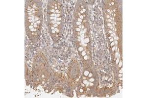 Immunohistochemical staining of human appendix with KCMF1 polyclonal antibody  shows moderate cytoplasmic positivity in glandular cells at 1:200-1:500 dilution. (KCMF1 Antikörper)
