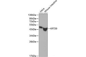 Western blot analysis of extracts of various cell lines using KRT20 Polyclonal Antibody. (KRT20 Antikörper)