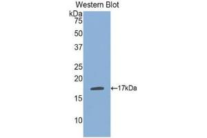 Western blot analysis of the recombinant protein. (PLA1A Antikörper  (AA 148-295))